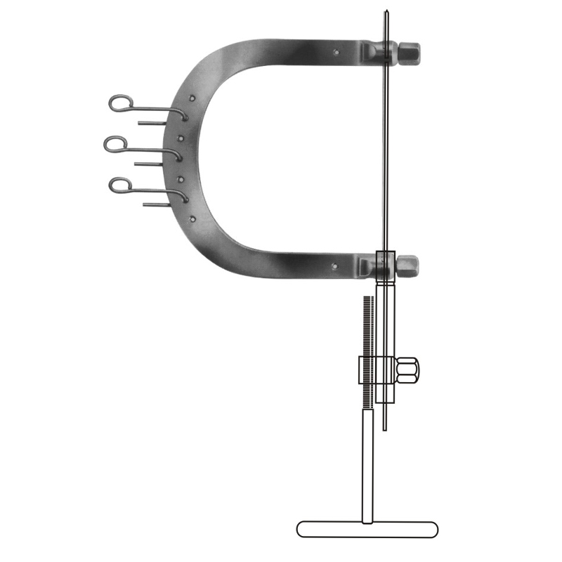 Kirschner Extension Bows